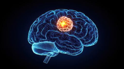 side-effects-of-brain-tumor-treatment